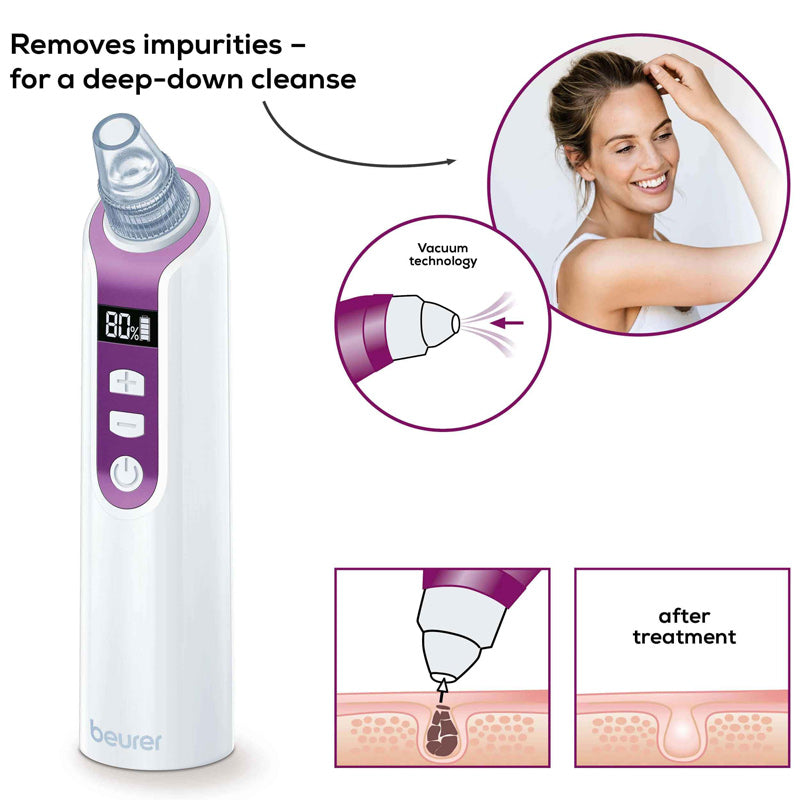 Beurer FC 41 electric blackhead remover and vacuum facial cleanser, white device, additional view 5
